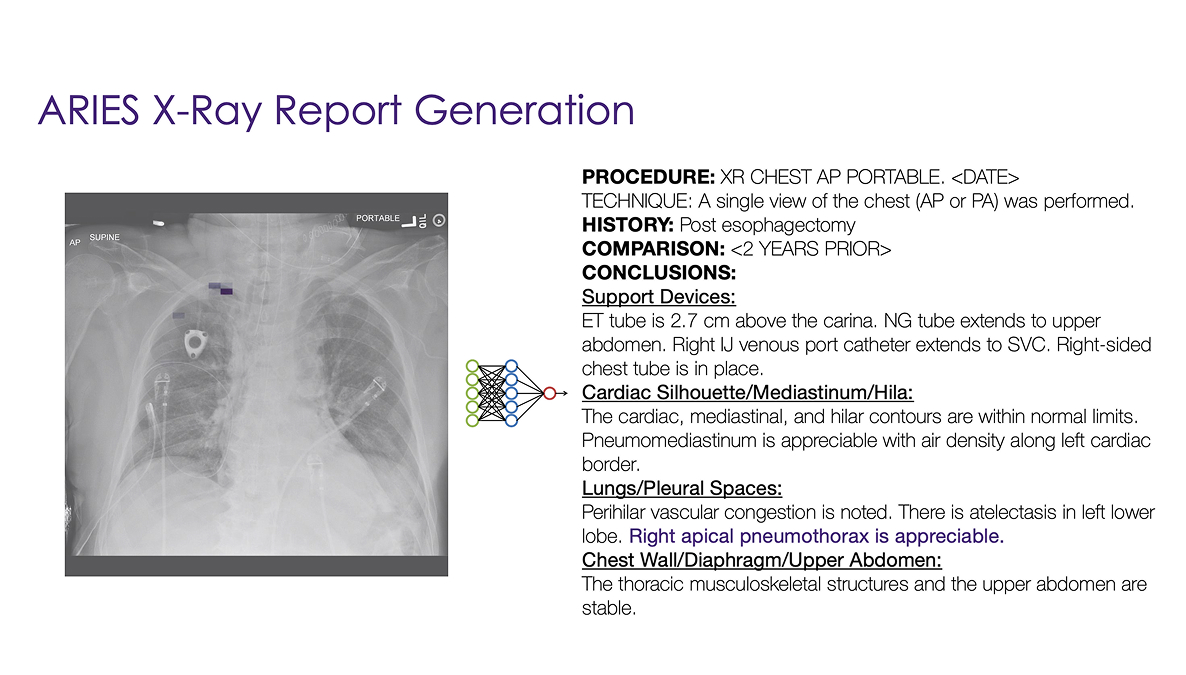 Generated X-Ray Report